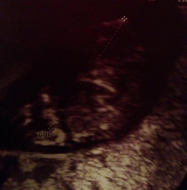 1798385_10151949397306674_842944816_n